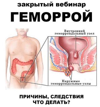 Геморрой — Братишка (2024)